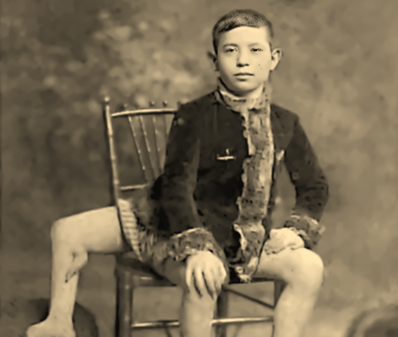 The Extraordinary Life Of The Three Legged Man